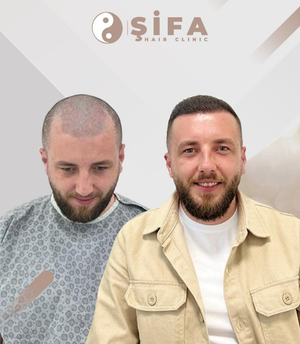 Operasyon sonrası ilk kontrol ve bakım eğitimi